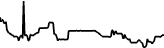 Nokia Corporation (Coinbase Tokenized Stock) (NOKC) price graph