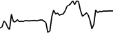 Rivian Automotive Tokenized Stock (Reality) (RRIVN) price graph